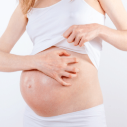 itching during pregnancy